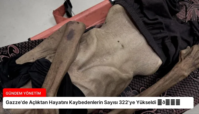 Gazze’de Açlıktan Hayatını Kaybedenlerin Sayısı 322’ye Yükseldi ⏬👇