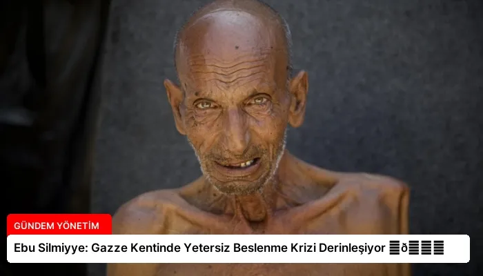 Ebu Silmiyye: Gazze Kentinde Yetersiz Beslenme Krizi Derinleşiyor ⏬👇